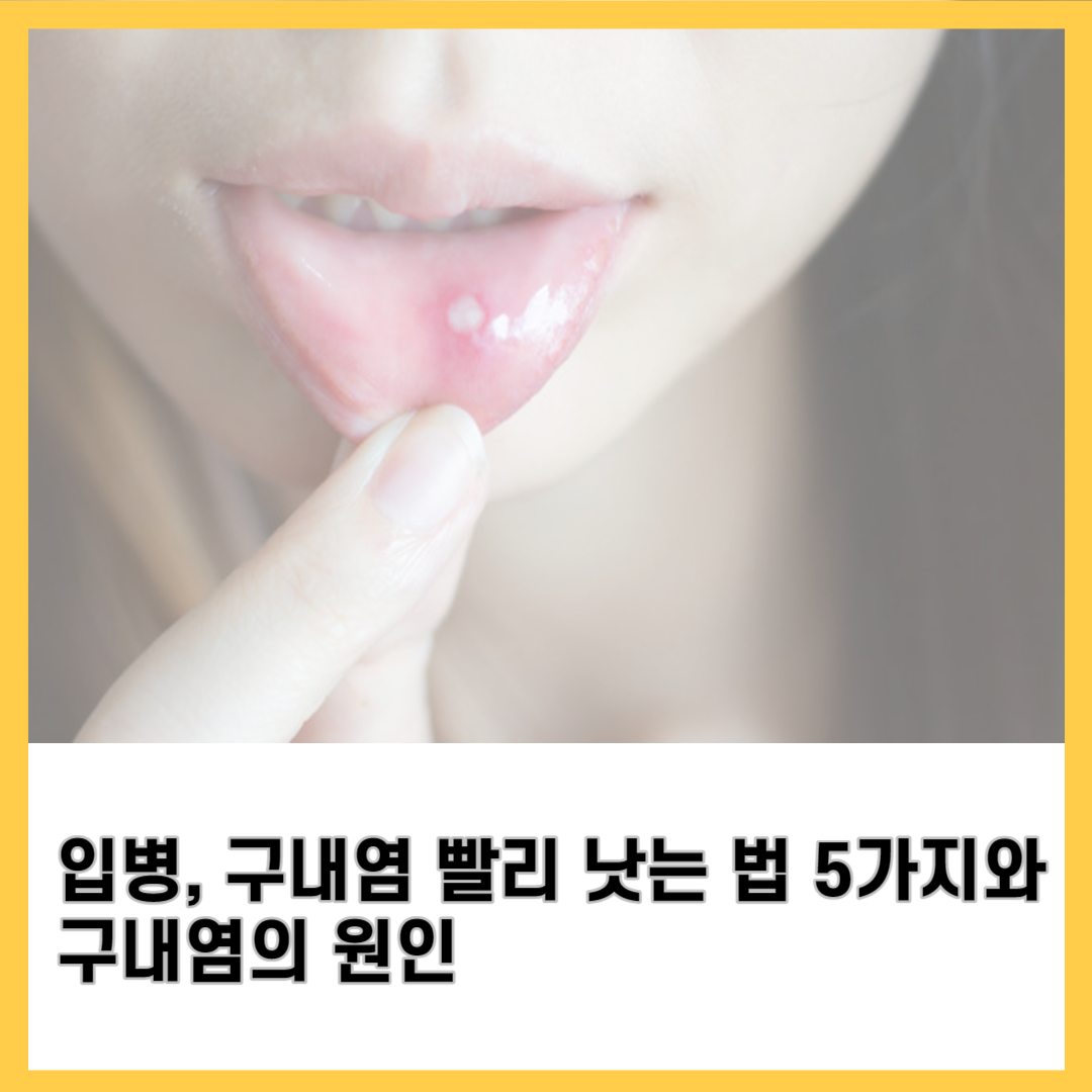 입병, 구내염 빨리 낫는 법 5가지와 구내염의 원인 - 건강 한스푼 블로그